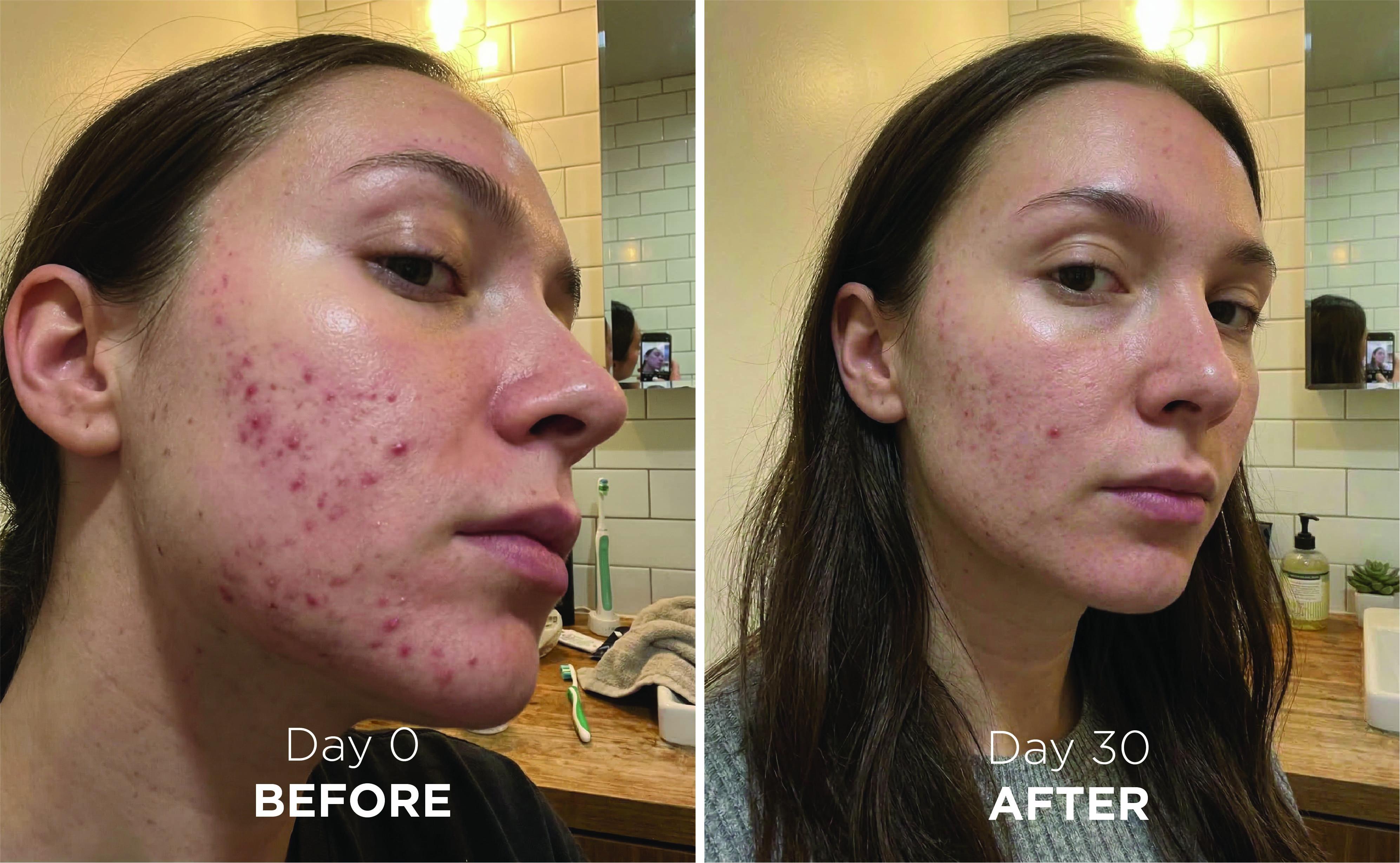 Before and after: skin tone